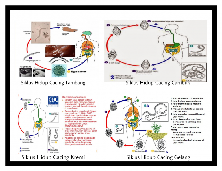 Cacingan Penyebab, Cara Mencegah dan Mengobatinya Belajar Epidemiologi